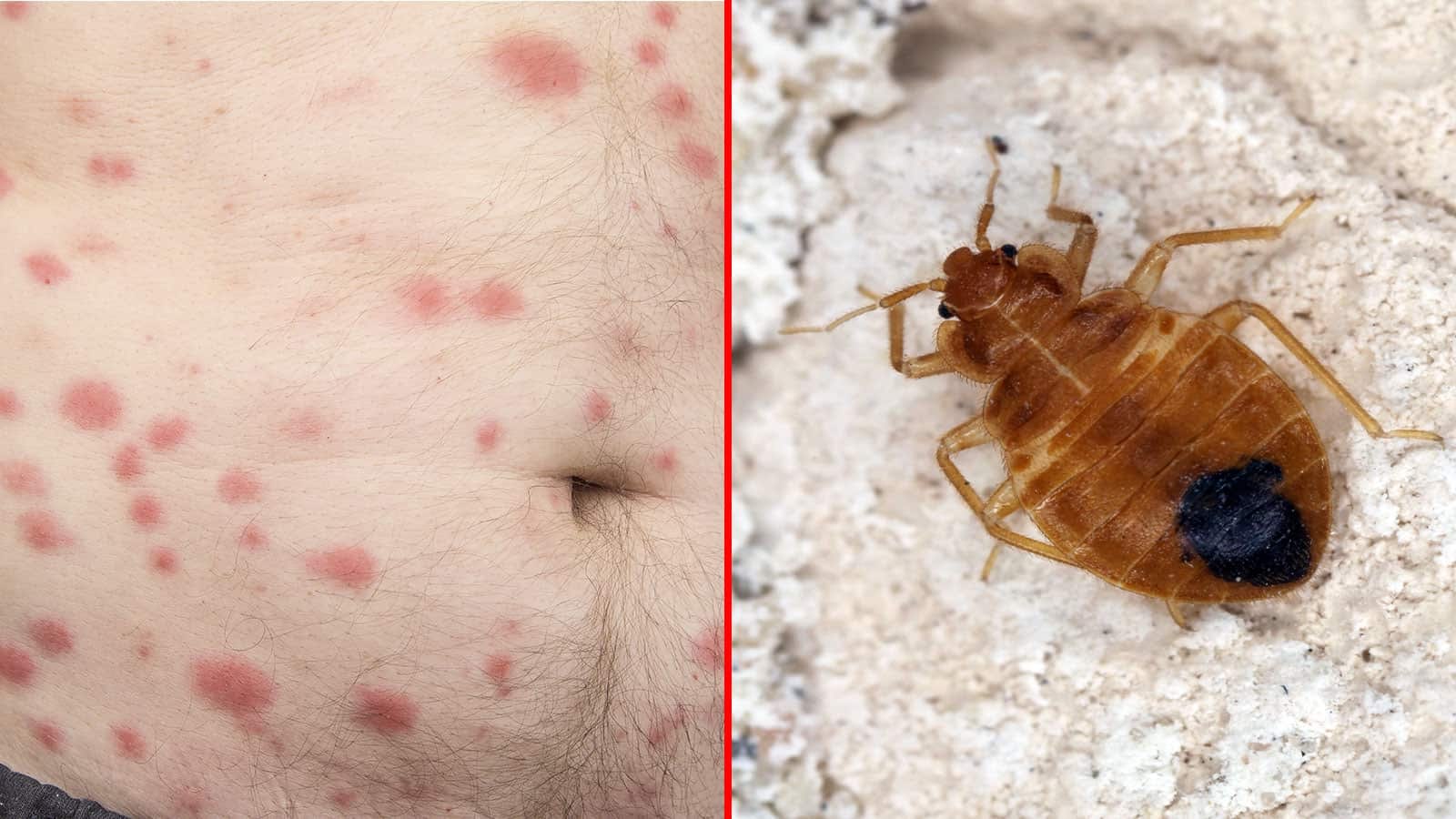 Never ignore bed bugs