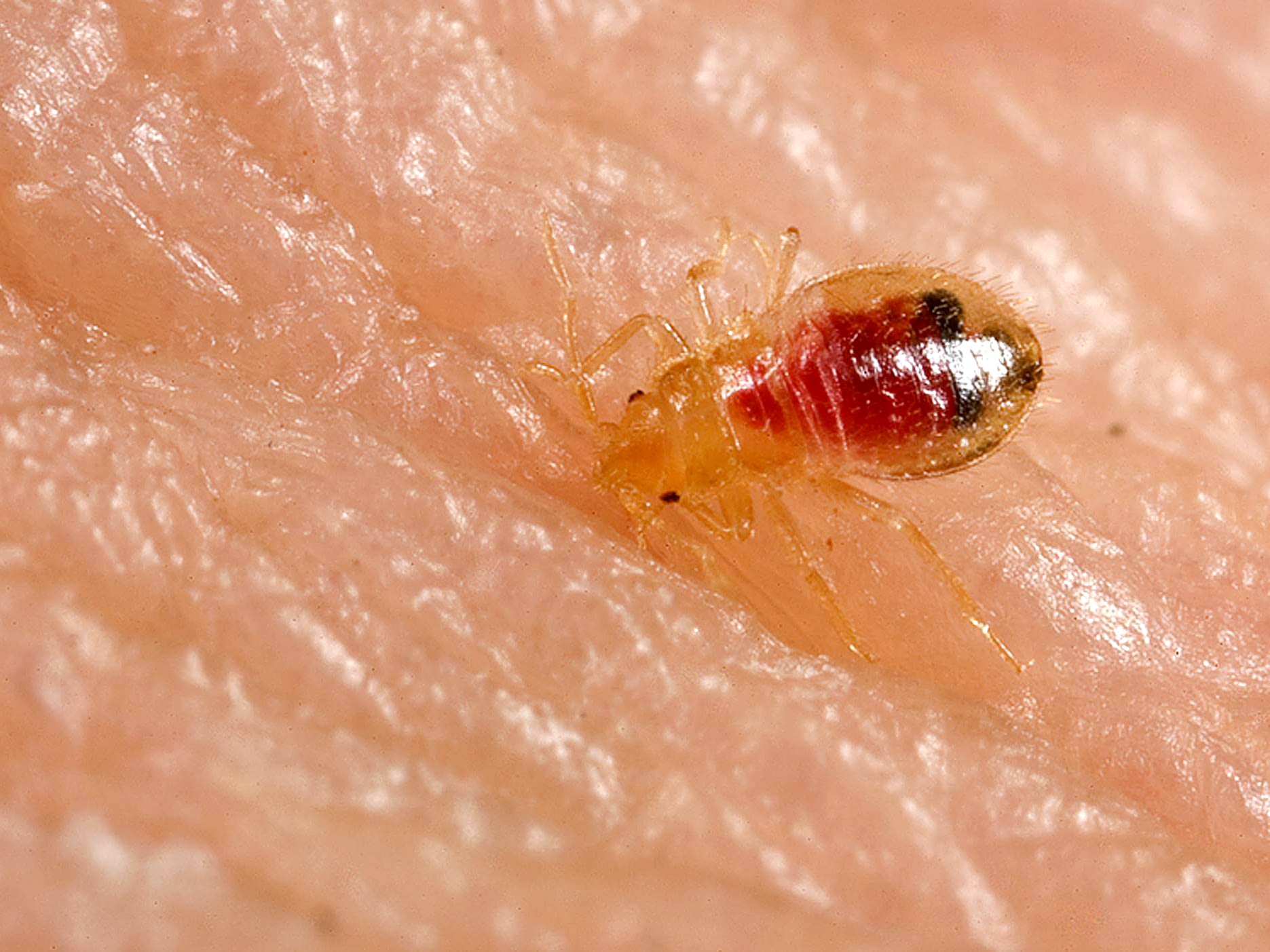 bedbug biting a human