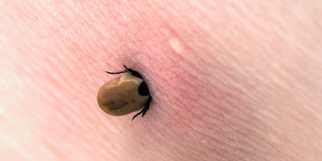 How To Identify Ticks | Images of Ticks | Doctor Pest